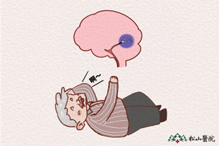 换了一个新枕头，退休老师突发脑梗